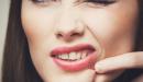 اسباب ظهور الحبوب في الوجه وعلاجها