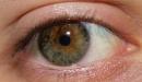 علاج جفاف العين طبيعيًا