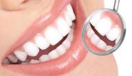 أسباب ضعف الأسنان