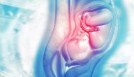 علامات اتساع عنق الرحم علامات اتساع عنق الرحم