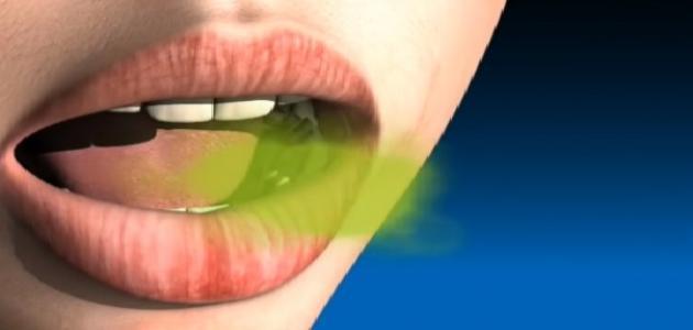 طرق ازالة رائحة الفم الكريهة نهائيا
