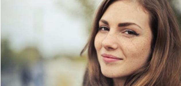أسباب ظهور النمش وعلاجه