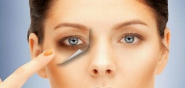علاج نهائي للهالات السوداء