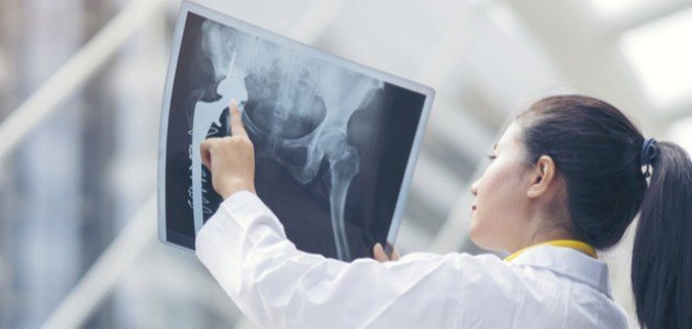 علامات سرطان العظام
