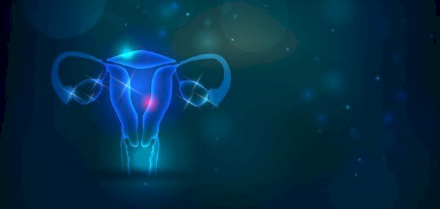 علاج تكيس المبايض بالماء: هل هي مثبتة علميًا؟