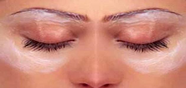 اسباب سواد حول العين