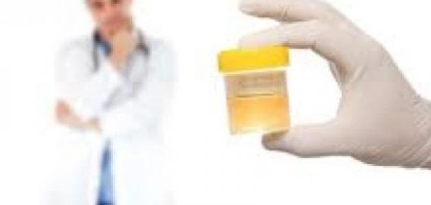 علاج صديد البول عند الحامل