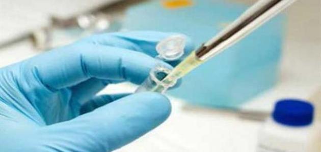 اسباب هرمون الحليب المرتفع