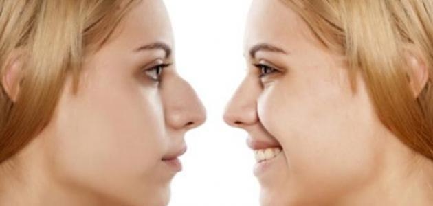 اضرار عمليات تجميل الانف