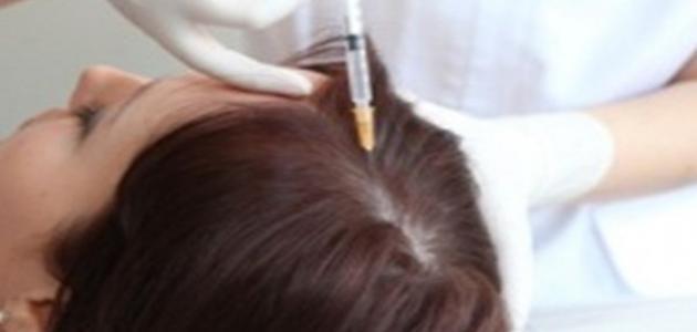 علاج تساقط الشعر بالميزوثيرابي